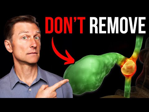 Never Get Your Gallbladder Removed